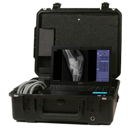 Digital X-Ray Digital X-Ray