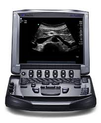 Digital Ultrasonography Machine